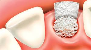 Excelência Implantodontia DentiCare